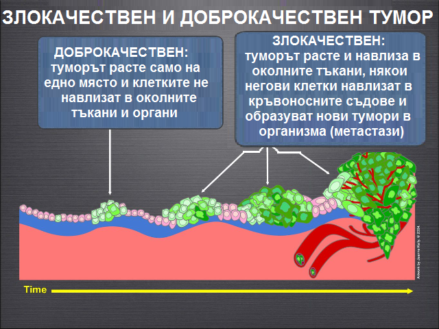 Лекарите, които проследяват и лекуват злокачествените форми на рак се ...